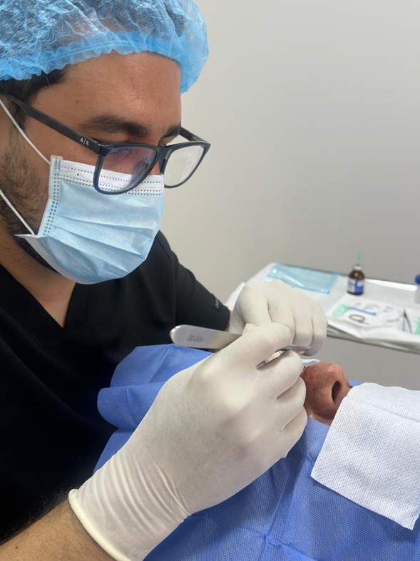 Dermatología Quirúrgica