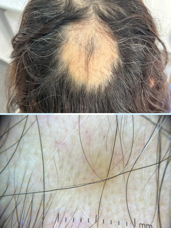 Examen físico y dermatoscópico