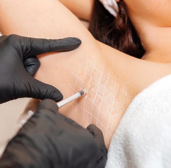 Tratamiento de la Hiperhidrosis