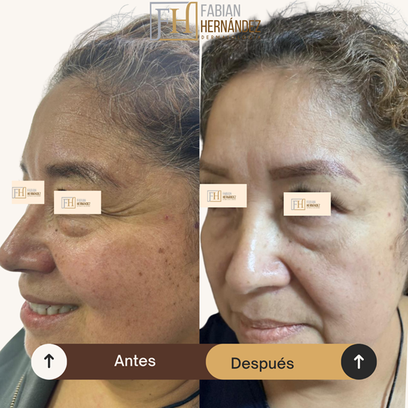 Manchas solares