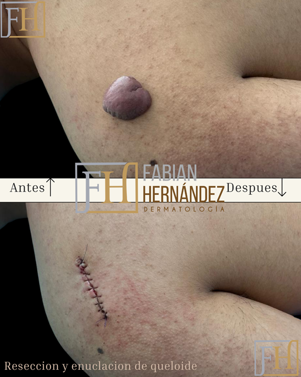 Antes y después 1