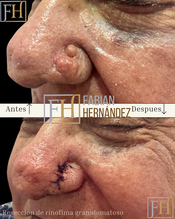 Antes y después 2